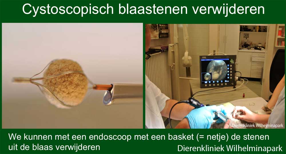 Met endoscoop kun je blaasstenen goed in beeld krijgen en verwijderen